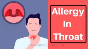 Read more about the article All to Know About allergy in throat and Cure