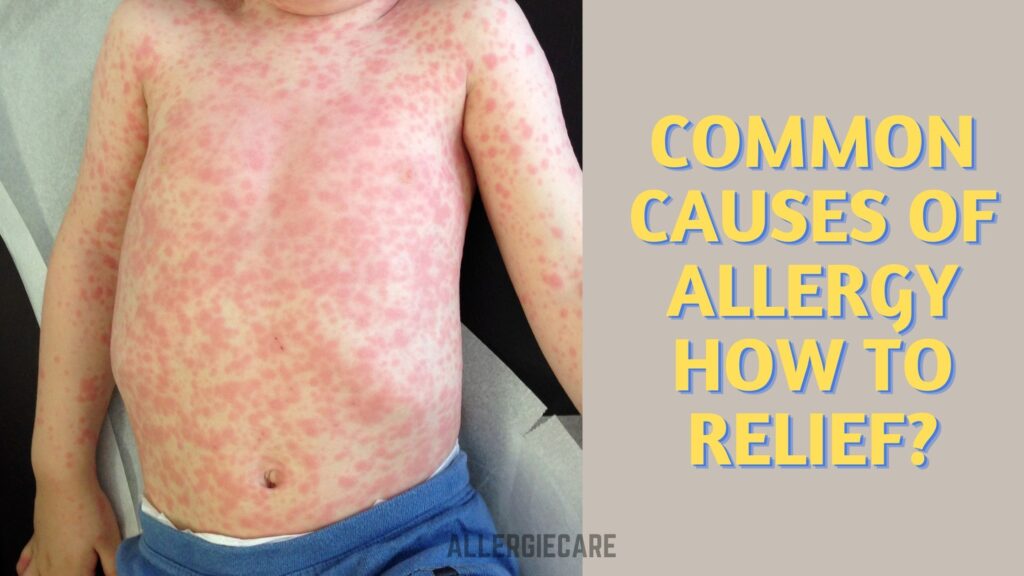 Common Causes of allergy and how to Relief? Allergie Care