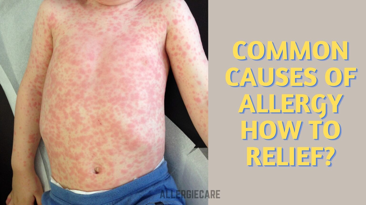 Common Causes of allergy and how to Relief? Allergie Care