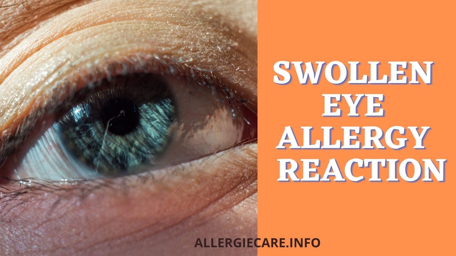 Best 5 home remedies for allergy in eyes Allergie Care