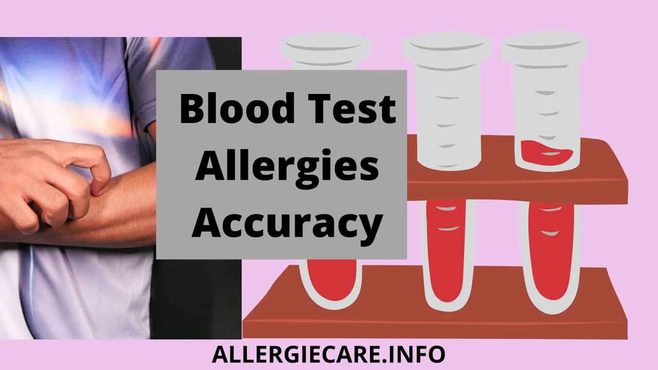 You are currently viewing Blood test allergies accuracy